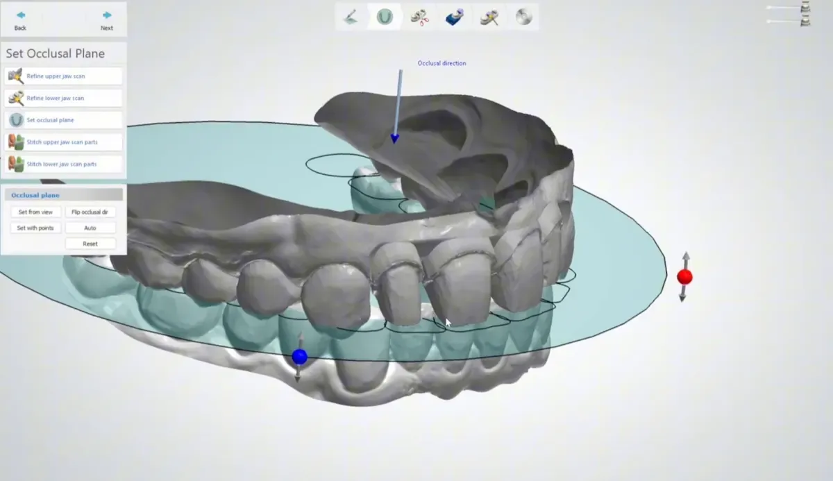 3Shape Model Builder : définition du plan occlusal des scans