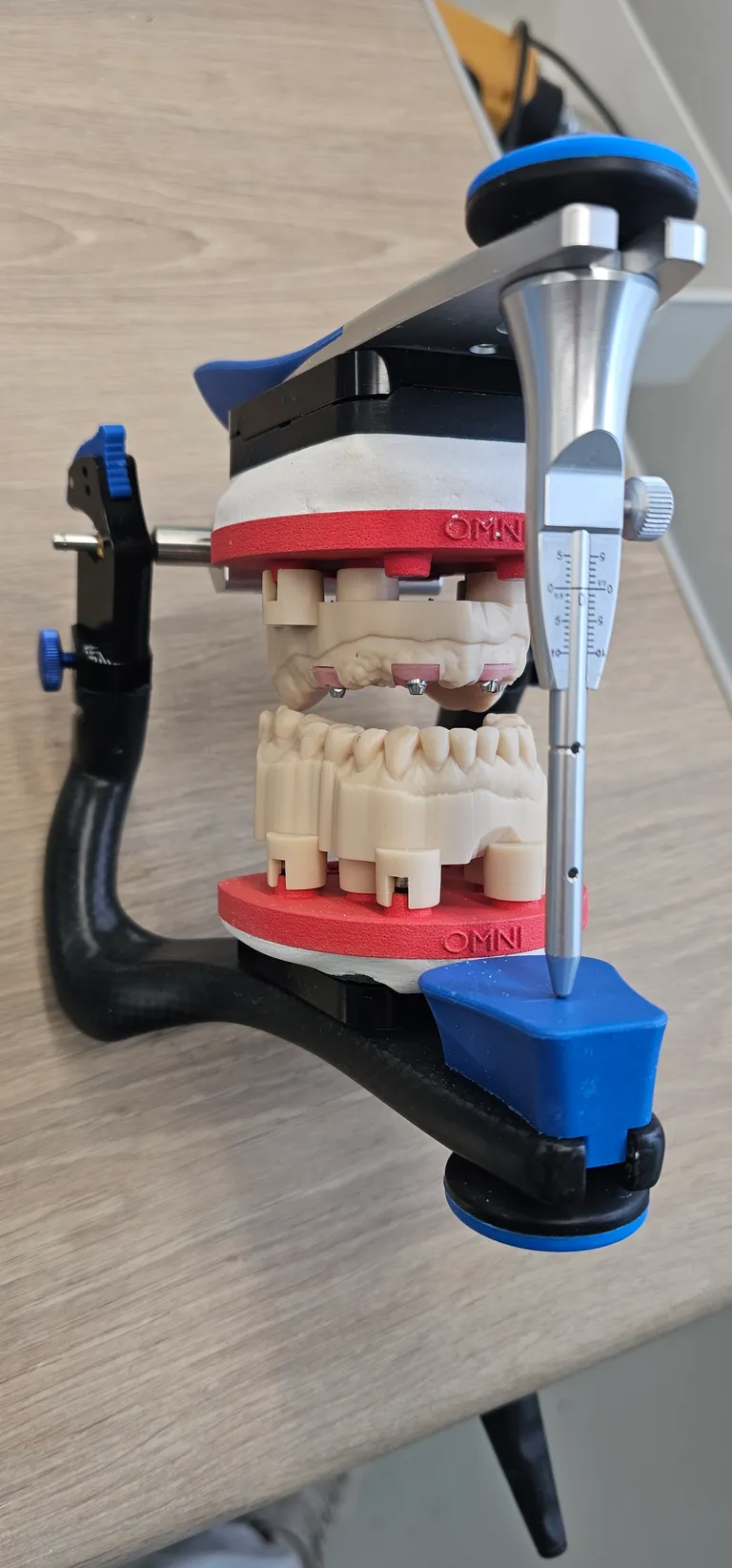 DACOS Omni plates mounted on an articulator