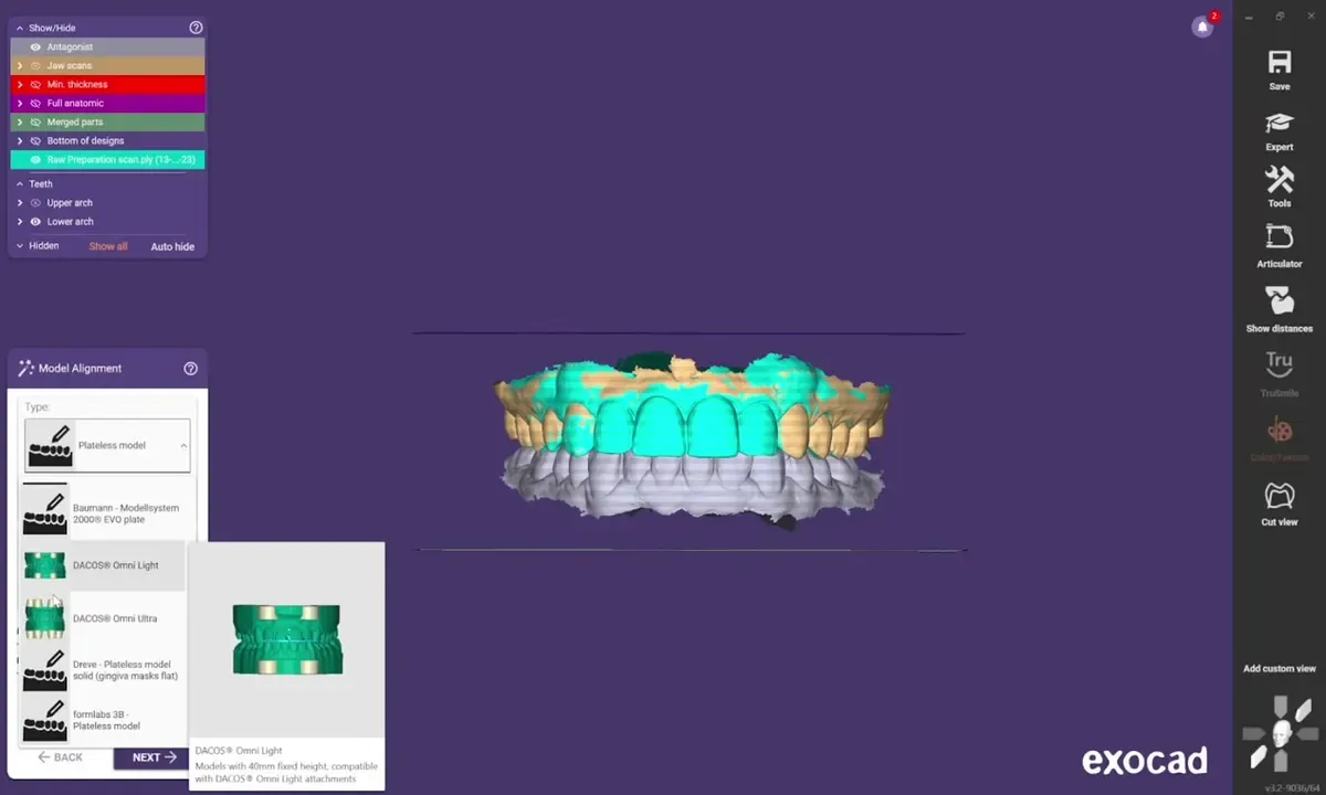 exocad Model Creator : choix du type de plaque DACOS Omni et de la hauteur du modèle