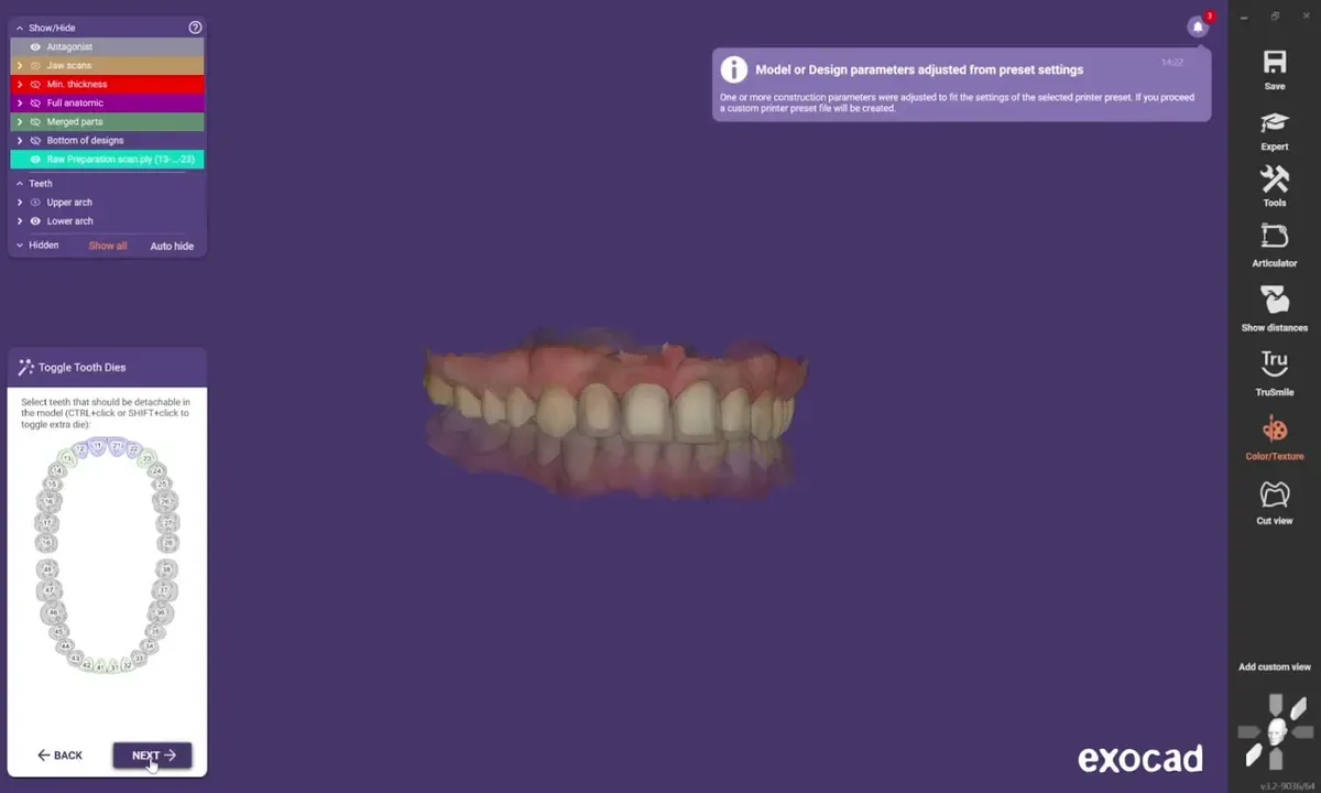exocad Model Creator : un modèle Light généré sur la plaque DACOS Omni