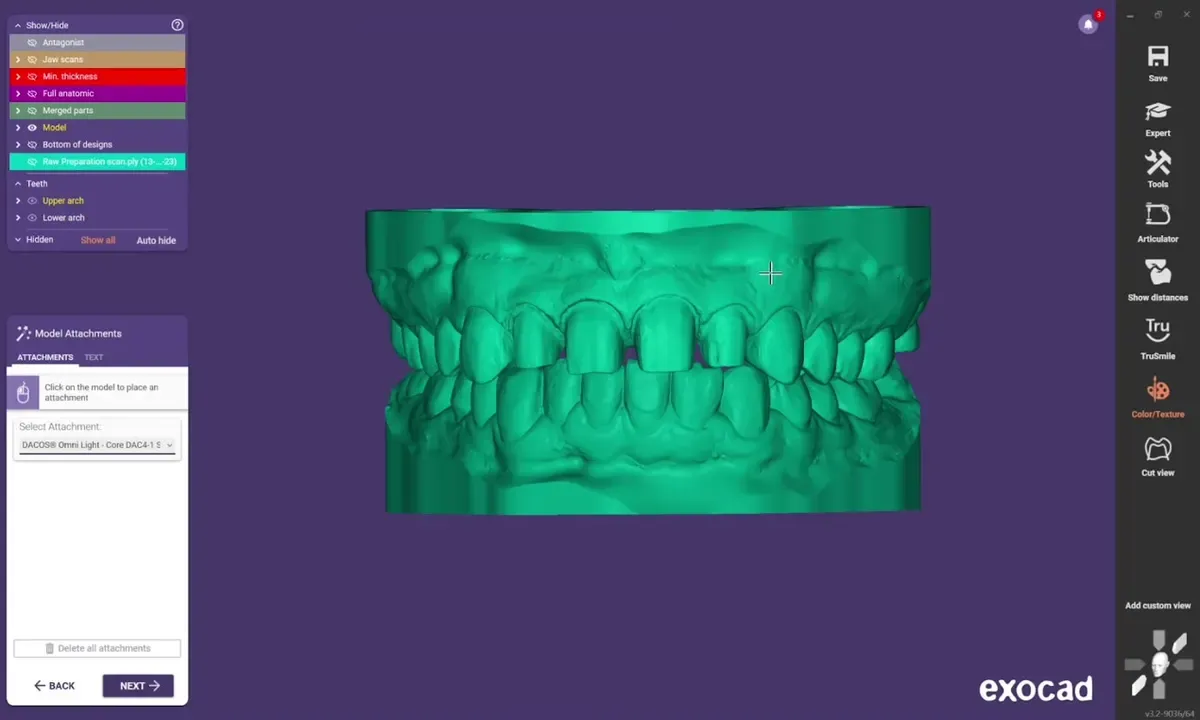 exocad Model Creator : le plan occlusal bleu tenu à l’écart du modèle