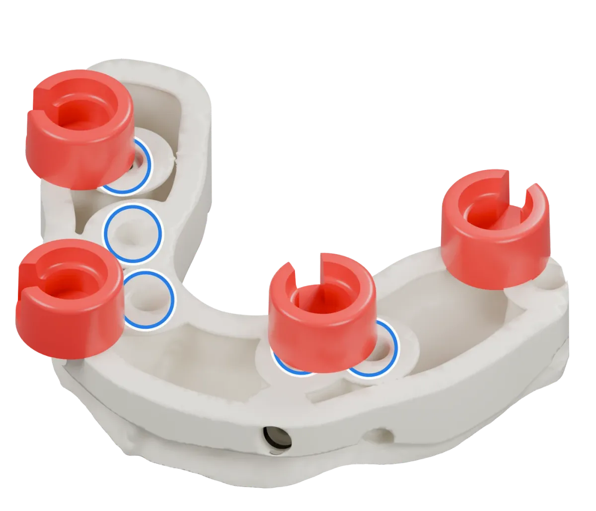 Rendu du même modèle sur implants avec les quatre logements DACOS rouges disposés en DAC4-1, positions 1 · 3 · 5 · 7, et des anneaux bleus sur les analogues d’implant.