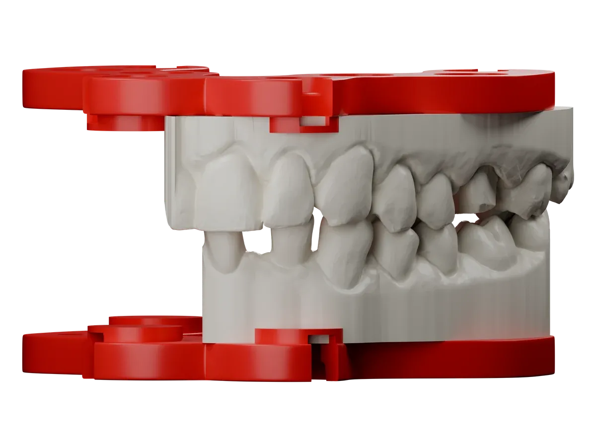 Rendu CAO d’un cas de couronnes supérieur et inférieur en occlusion, vue de face légèrement de biais, chaque modèle sur son Frame DACOS rouge.