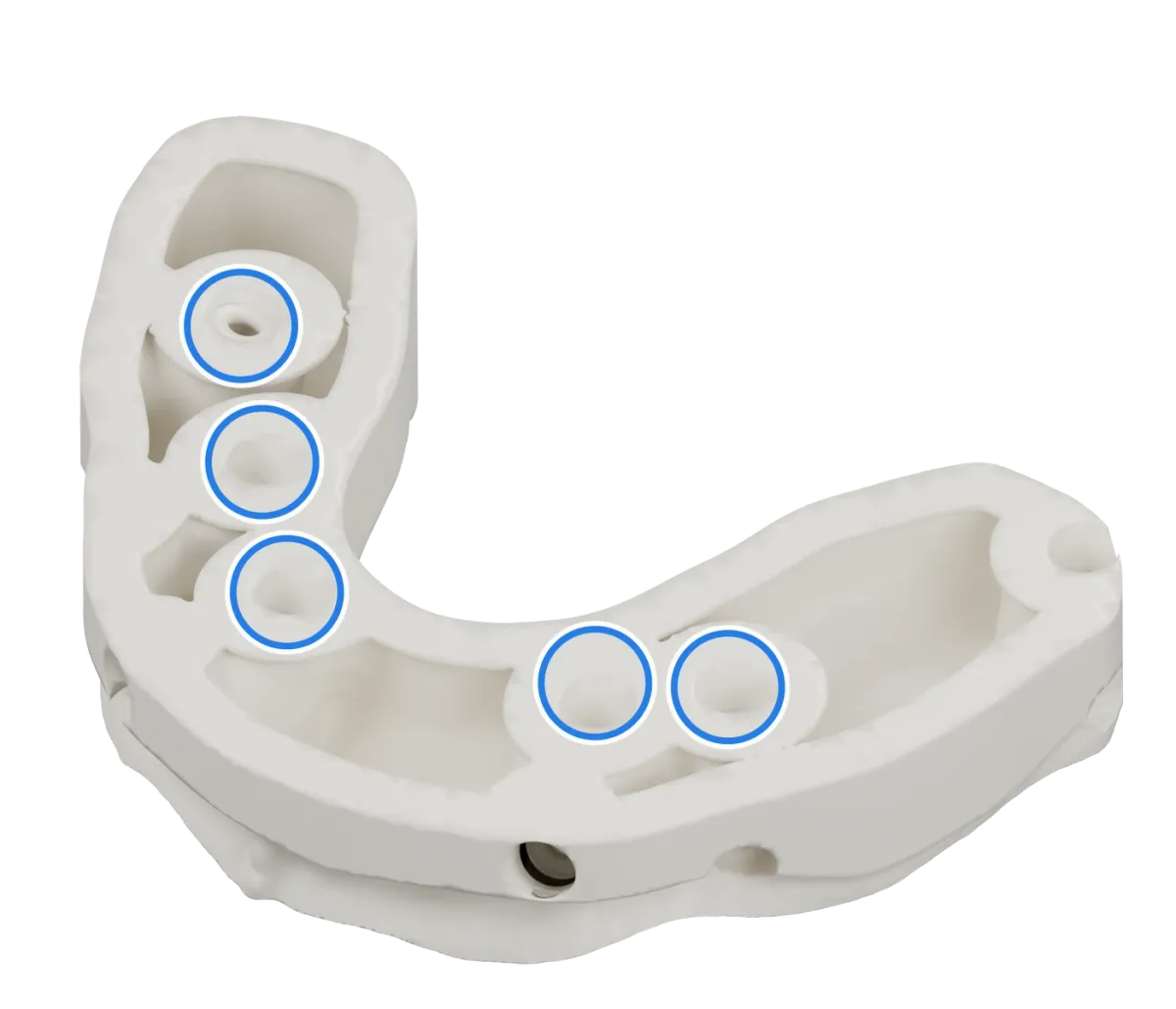 Rendu d’un modèle sur implants vu côté socle, avec des anneaux bleus autour de ses cinq analogues d’implant.