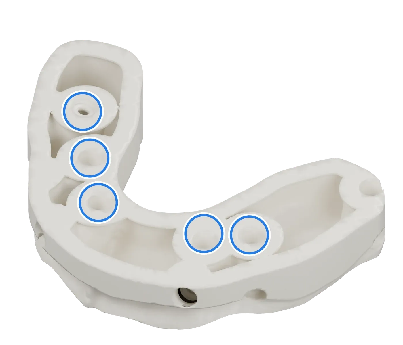 Rendering of a model on implants seen from the base, with blue rings around its five implant analogs