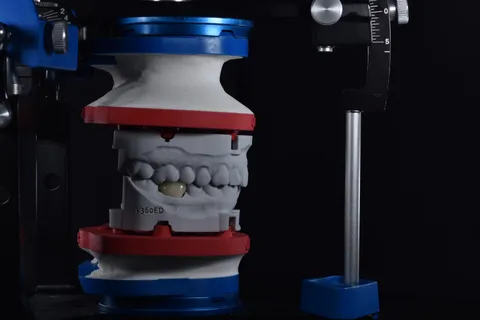 Printed models mounted with DACOS Omni plates in a Panadent articulator