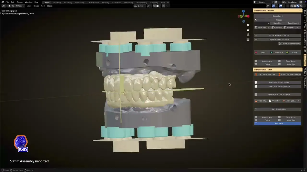 Blender for Dental avec le module DACOS Omni qui place des attachements sur un modèle
