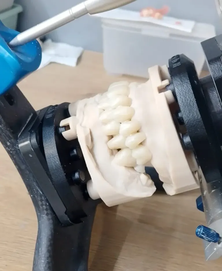 Printed arch on DACOS Omni plates in a carbon articulator