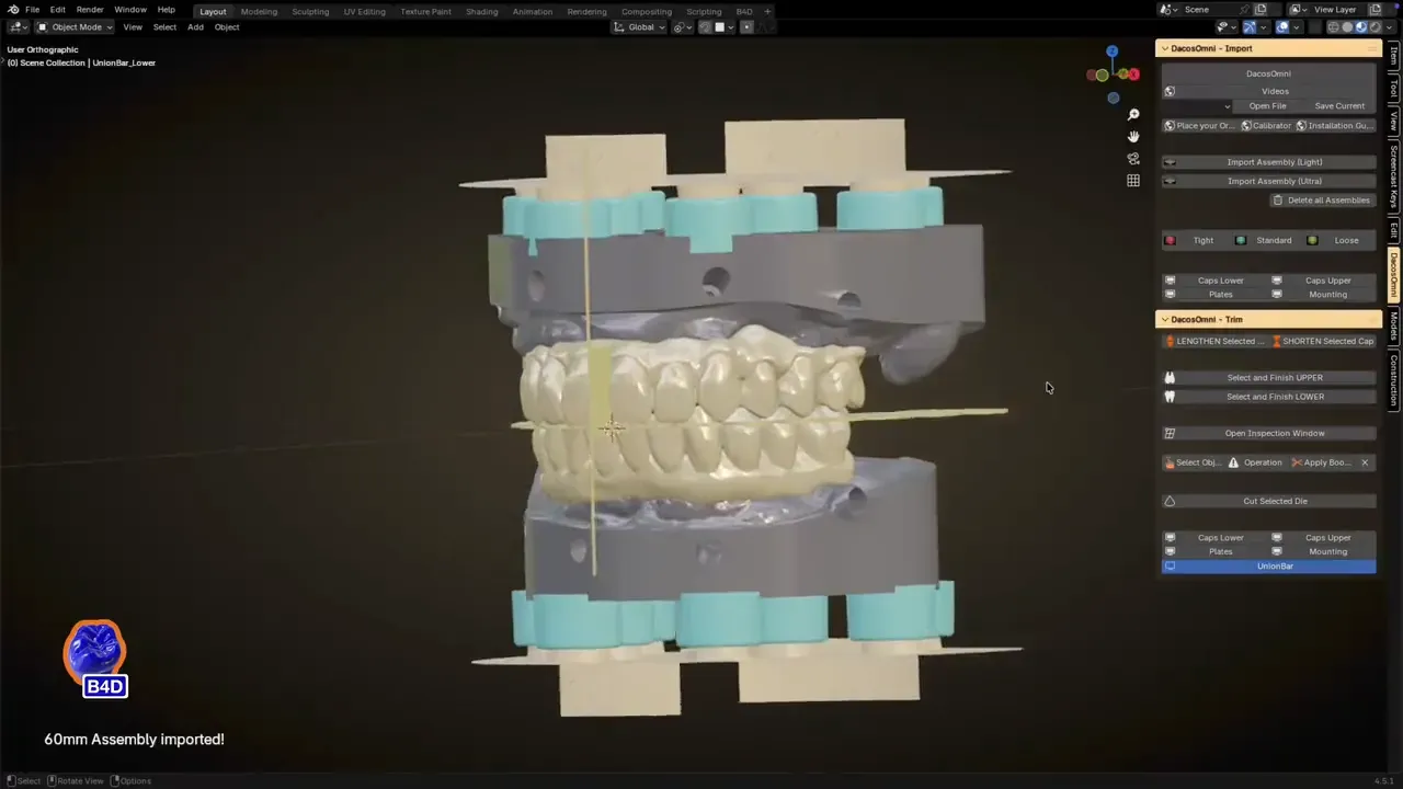 Blender for Dental avec le panneau du module DACOS Omni : l’assemblage importé, modèles supérieur et inférieur en occlusion entre les rangées d’attachements.