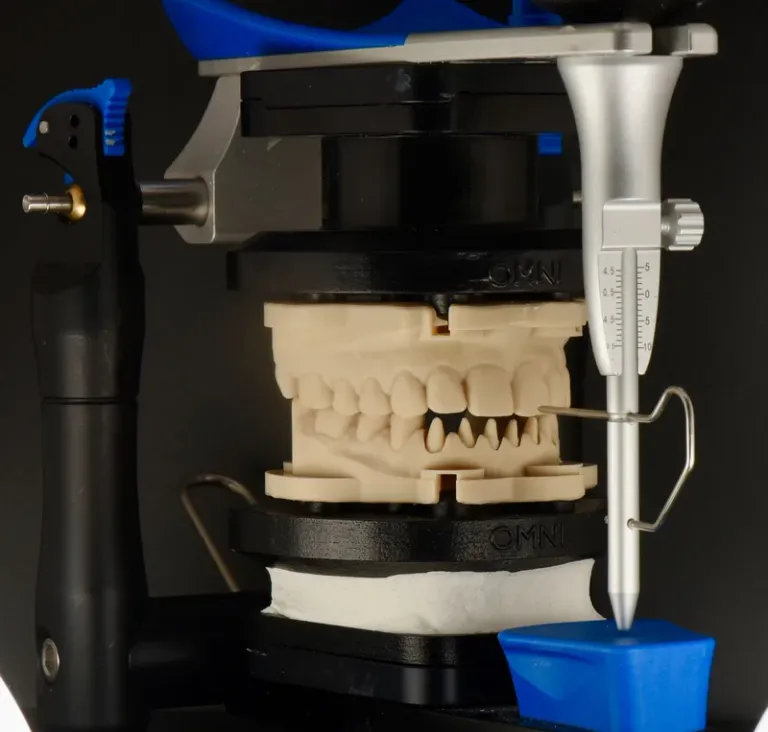 Printed model and incisal pin on an articulator with DACOS Omni plates